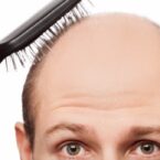 مکانیزم موثر در طاسی و خاکستری شدن مو کشف شد