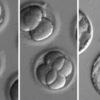کریسپر با موفقیت یک بیماری ژنتیکی را از DNA جنین انسان پاک کرد