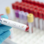 نتایج موفقیت آمیز آزمایش یک واکسن جدید برای HIV
