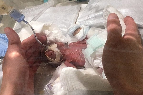کوچک‌ترین نوزاد پسر دنیا پس از پنج ماه مراقبت ویژه به خانه رفت