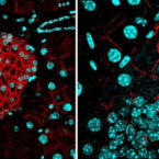 کشف نحوه مقابله سلول‌های بدن با پیشرفت سرطان