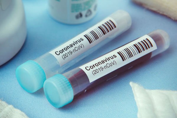 صدور اولین مجوز تست پادتن برای تشخیص کرونا توسط سازمان غذا و داروی آمریکا