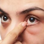 یافته جدید محققان: ویروس کرونا میتواند چندین روز در چشم زنده بماند