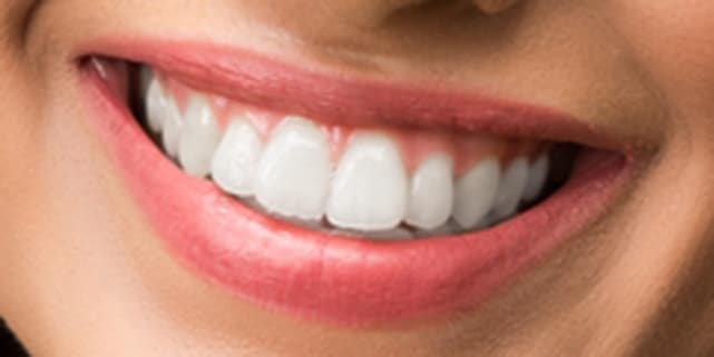 سفید کردن دندان در فتوشاپ