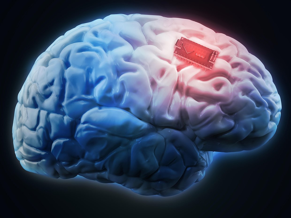 توسعه ایمپلنت مغزی که می‌تواند به سرعت درد را تشخیص و تسکین دهد