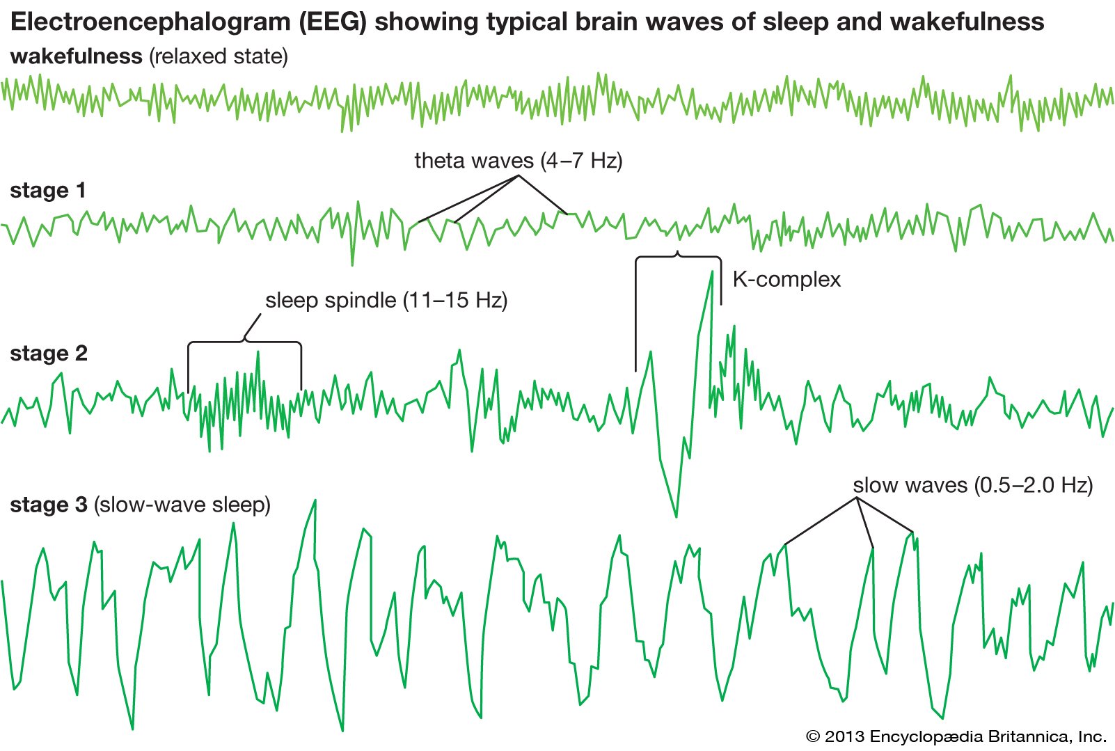 Время активности мозга. ЭЭГ-корреляты фаз сна.. Фазы медленного сна ЭЭГ. ЭЭГ В разные фазы сна. Rem фаза сна ЭЭГ.