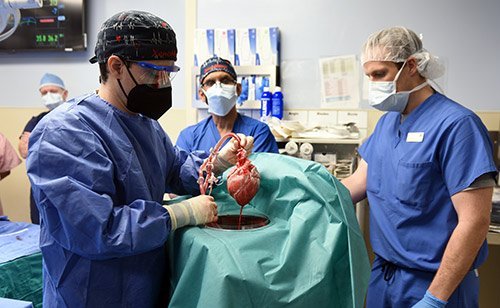 جراحی پیوند قلب