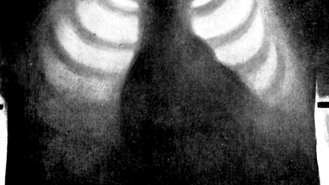 اولین ابزار هوش مصنوعی تحلیل عکس‌های اشعه ایکس تاییدیه اتحادیه اروپا را دریافت کرد