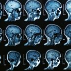پروژهای با حضور صدها محقق از سراسر جهان؛ 120 هزار اسکن MRI از تغییرات مغز