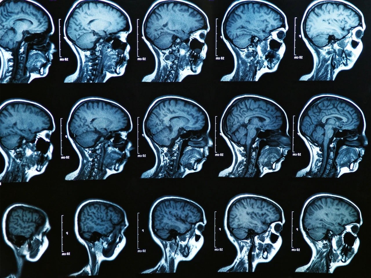 پروژه‌ای با حضور صدها محقق از سراسر جهان؛  120 هزار اسکن MRI از تغییرات مغز
