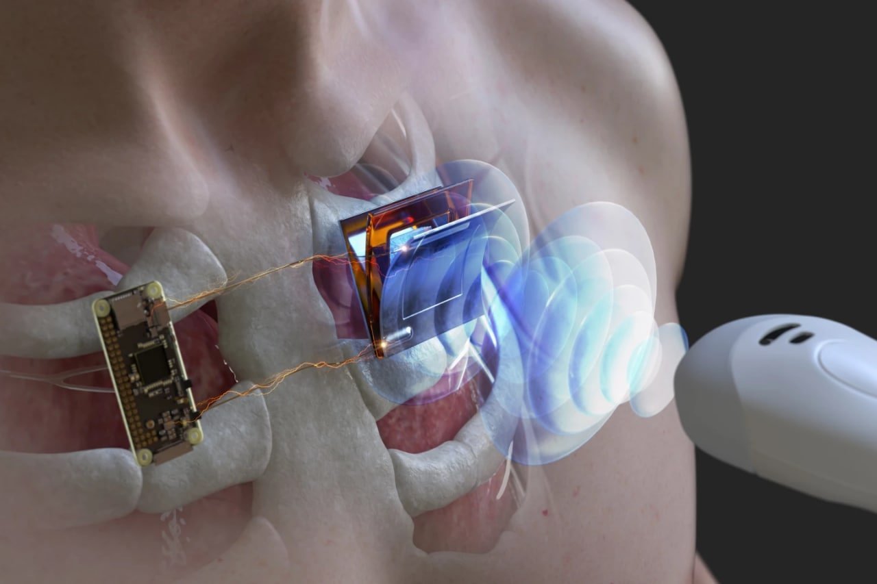 دانشمندان روی توسعه فناوری اولتراسوند برای شارژ باتری ایمپلنت‌ داخل بدن کار می‌کنند