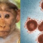 روزیاتو: آبله میمون یا ویروس میمون B چیست؟