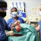 پزشکان علت مرگ بیمار دریافت‌کننده قلب خوک اصلاح ژنتیکی شده را اعلام کردند