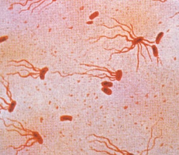 پزشکان از افزایش مقاومت تب حصبه در برابر آنتی‌بیوتیک‌ها خبر می‌دهند
