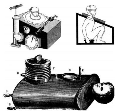 طراحی دستگاه‌های ونتیلاتور در قرن 19 میلادی