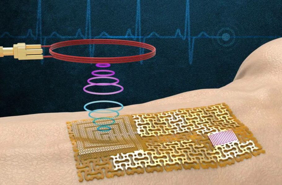مهندسان MIT حسگر پوستی بی‌سیم بدون تراشه و باتری برای نظارت روی سلامتی ساختند