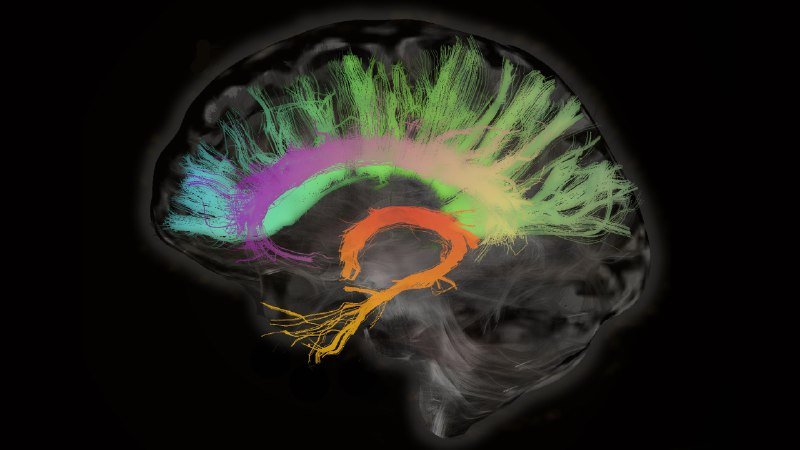 پژوهشگران با تحریک الکتریکی مغز، حافظه افراد مسن را بهبود بخشیدند