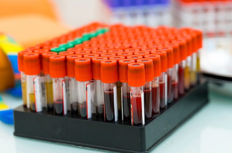 دانشمندان با یک زیست‌نشانگر خون می‌خواهند دیابت را قبل از بروز علائم تشخیص دهند