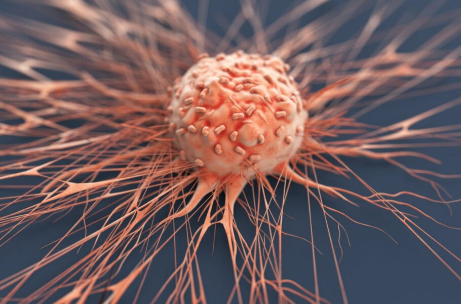 اطلاعات مهم درباره انتشار سلول های سرطانی در بدن دست پیدا کردند